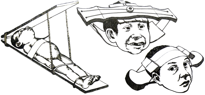 Métodos para deformação craniana artificial usados pelos maias! (imagem: Reprodução/Wikipédia)