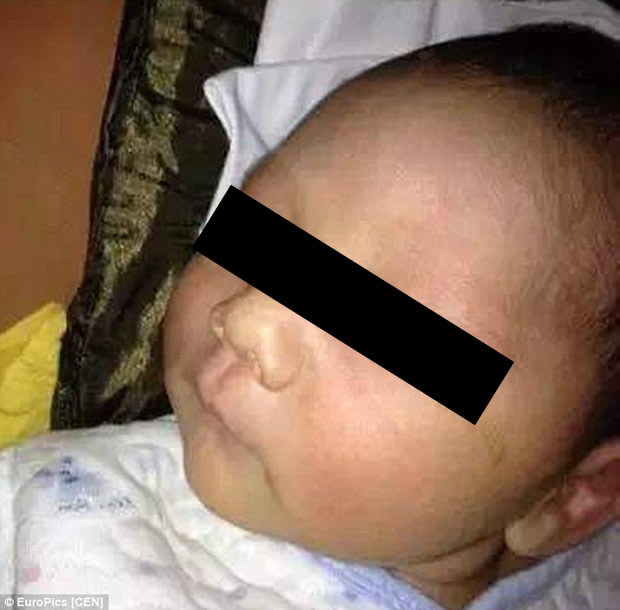 Bebê teria ficado cego após ser exposto ao flash da câmera! Será verdade? (foto: Reprodução/Facebook)