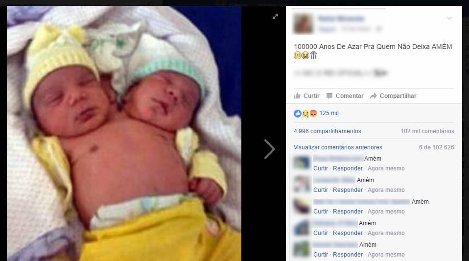 Bebê de 2 cabeças pede o seu amém no Facebook! Será verdade?