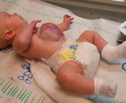 Bebê com os órgão para o lado de fora do corpo pede sua ajuda!