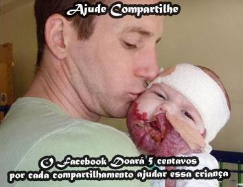 Compartilhe a foto e ajude esse bebê com doença grave no rosto!