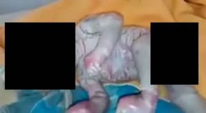 Bebê teria nascido em Feira de Santana com problemas na pele! Será verdade? (foto: Reprodução/Facebook)