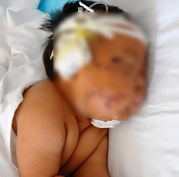 Imagem mostra bebê que teria levado 90 tesouradas da própria mãe! Será verdade? (foto: Reprodução)