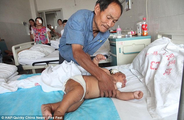 O pequeno Xiao recebendo cuidados no hospital!