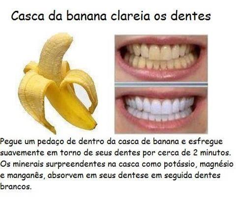 Casca de banana clareia os dentes?