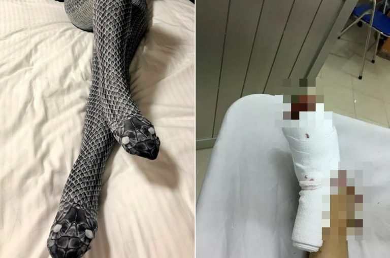 Homem bateu na esposa após confundir sua meia-calça com uma cobra de verdade?