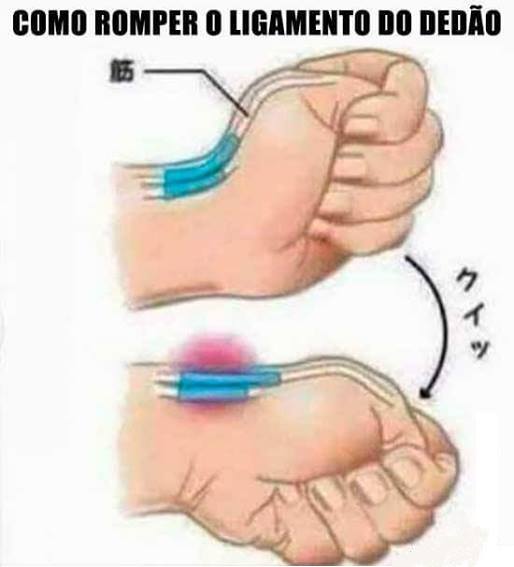 Como romper os ligamentos da mão?