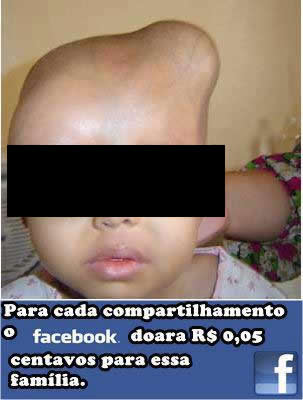 Criança com a cabeça deformada pede sua ajuda no Facebook