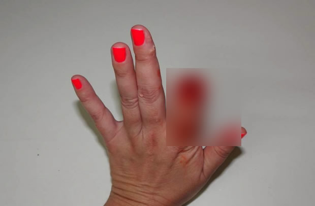 Dentista teve o dedo decepado pela mordida de uma criança! Será verdade? (foto: Reprodução/Facebook)