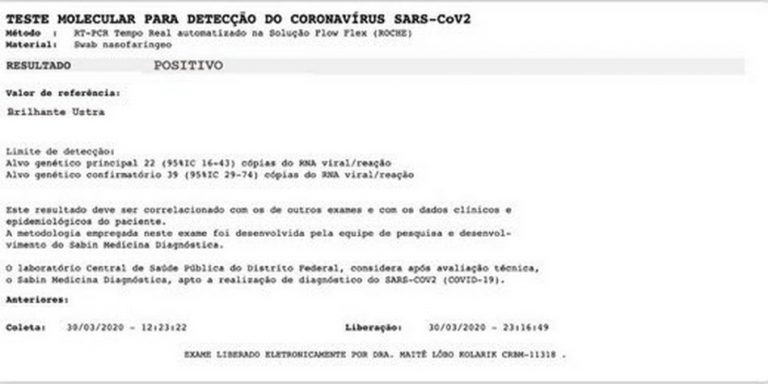 Exame positivo para COVID-19 codificado como “Brilhante Ustra” pertence a Jair Bolsonaro?
