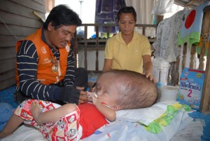 Criança com hidrocefalia pede 3 thai baht para ajudar no seu tratamento!
