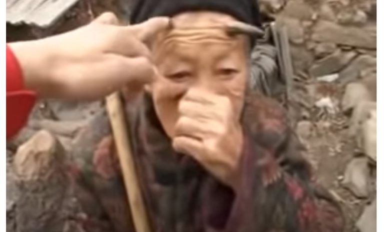 Zhang Ruifang, a chinesa de 100 anos que tem chifre na testa!