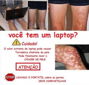 Alerta espalhado pelas redes sociais sobre queimaduras causadas pelo uso de laptops! (reprodução: Facebook)
