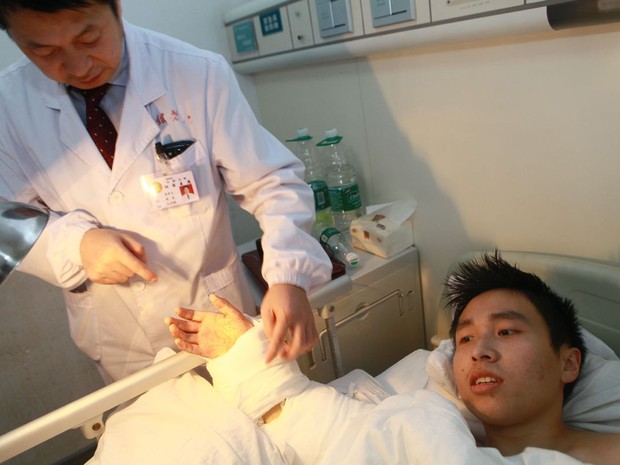 A equipe do Dr. Tang Juyu recolocou a mão do paciente de volta no local correto! 