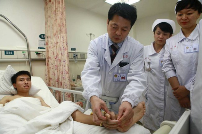 Após a cirurgia, chinês passou 1 mês com a mão presa no pé! (Foto: HAP/Quirky China News/Rex Images)