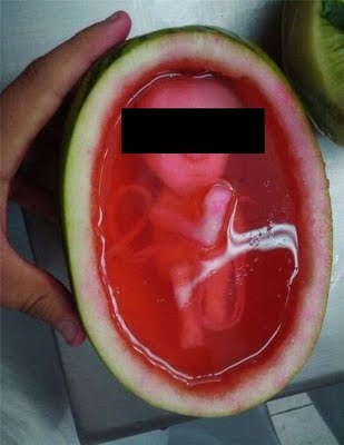Bebê fecundado dentro de uma melancia é mistério na Rússia