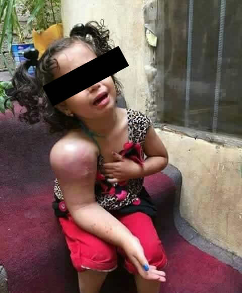 Criança com o braço inchado pede orações no Facebook! Será verdade? (foto: Reprodução/Facebook)