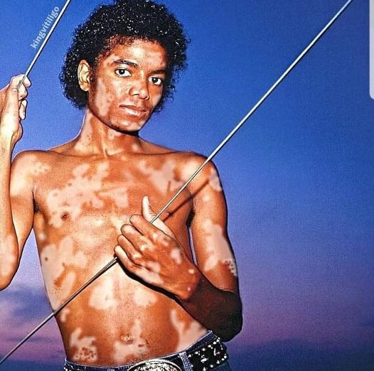 Michael Jackson sem camisa e com o corpo cheio de manchas! Será verdade?