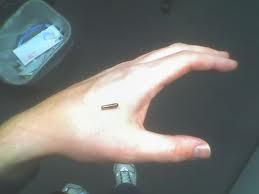 Microchip estaria sendo implantada sob a pele