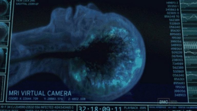 Ressonância magnética mostrou o cérebro de uma pessoa morrendo?
