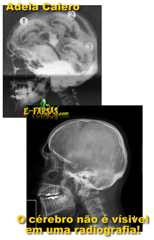 Radiografia de cranio