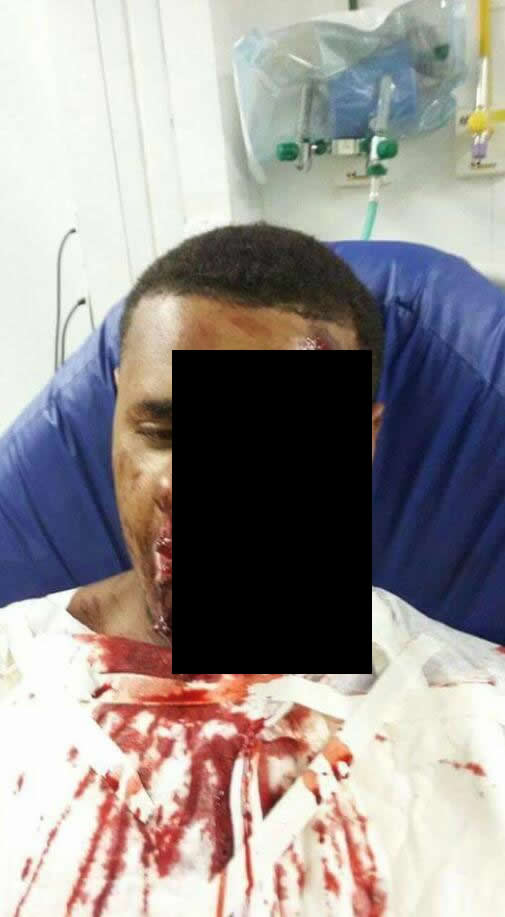Rapaz teve metade do rosto desfigurada ao usar o celular ligado na tomada! Será verdade? (foto: Reprodução/WhatsApp)