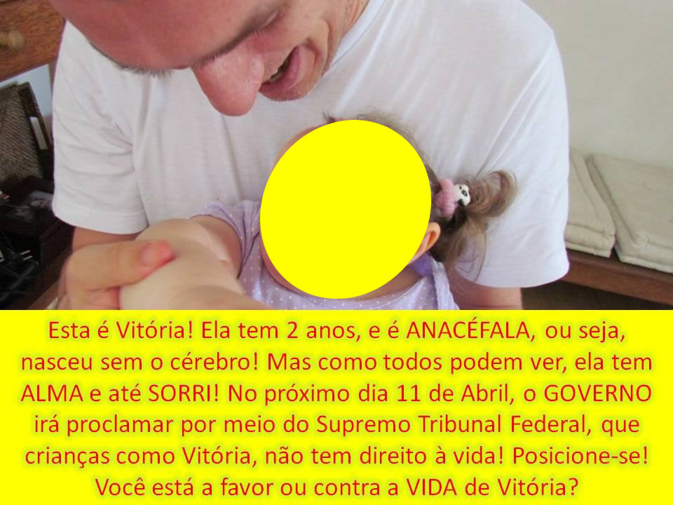 Foto de menina “anacéfala” vira campanha no Facebook